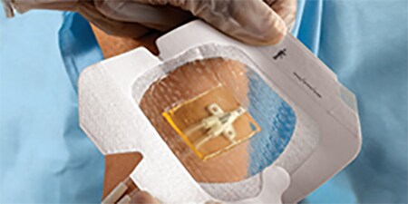 3M™ Tegaderm™ Antimikrobiální ochrana
